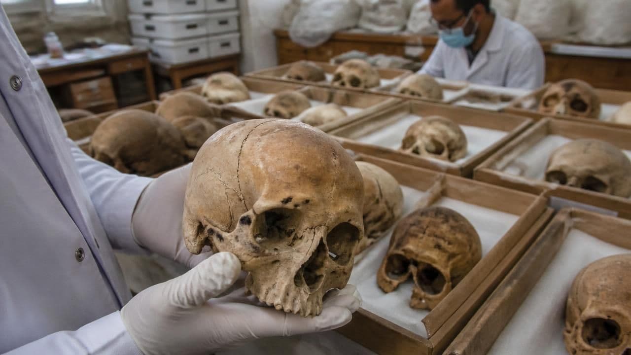 Forensic Study Finds Blunt-Force Trauma in Skulls of Egypt's First Dynasty Retainers